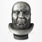 Constipation - Messerschmidt